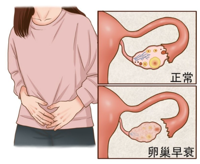 <b>【解惑】我卵巢早衰了，做试管成功的几率有多大？</b>