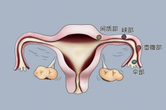 女性没有输卵管能做试管吗？答案是肯定的！
