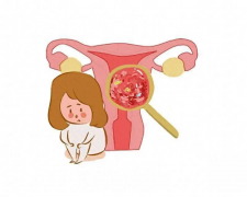 宫颈囊肿遇上试管宝宝：探索试管移植流程，解读成功率