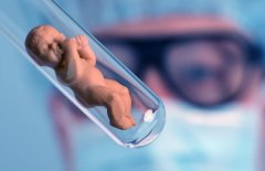 子宫囊肿患者试管怀孕之路：费用、流程与成功率解析