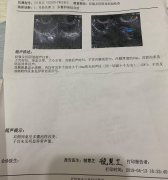 45岁多囊卵巢综合征,在深圳北大医院做试管成功率是多少?