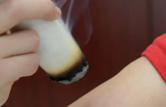 艾灸贴使用需谨慎！位置贴不对，卵巢恢复受影响，千万要小心！