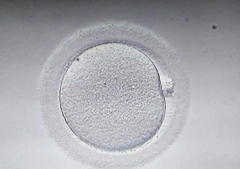 女性可以用冻卵做试管吗？丧偶女性试管指南！