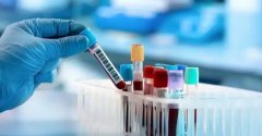 长沙哪里可以做试管？价格实惠的医院在这里！