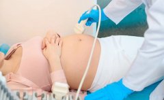 子宫内膜异位症B超显像：从卵巢到子宫的细致观察