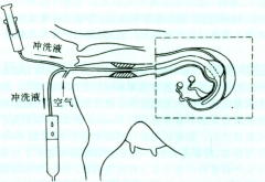 <b>三代试管取卵后多久可以移植?冻胚移植要等多久?</b>