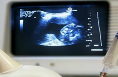 2026年在马来西亚做三代试管婴儿真的能包成功吗？流程与注意事项全解