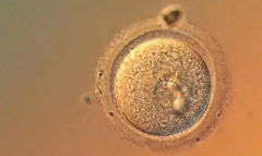 揭秘苏大附二院未婚做试管婴儿多少钱，一次预算12万才够