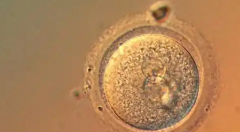 警惕虚假宣传！2026重庆三代试管婴儿包成功？附真实流程