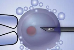 广州三代试管包成功必看！2026医院选择及流程攻略