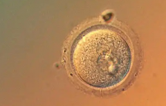 在宁夏做一次三代试管婴儿需要花费多少钱？怎么做更省钱？