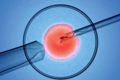 柬埔寨三代试管婴儿费用明细公布？推荐本地优质医院及价格参考