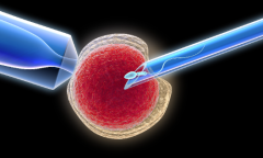 杭州市人工授精费用清单表，来看下参考价格