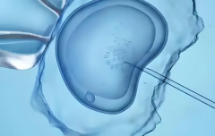 2026年未婚人士去北京东方医院做试管大概要花多少钱？