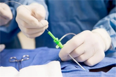 单身人士能在华中科技大学同济医学院附属协和医院做试管婴儿吗？费