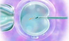 2026年在浙江杭州做第三代试管婴儿助孕大约需要多少费用