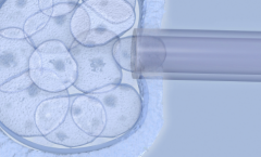2026西安市三代试管包成功最新政策：流程/费用及注意事项