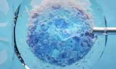 2026年湛江第三代试管助孕费用清单：单周期费用通常在10至15万元