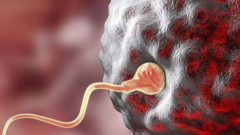 柬埔寨私立医院试管包成功可信度究竟如何？