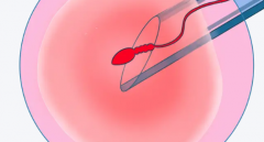 美国第三代试管成功率高的医院能包成功吗？需要去几次？