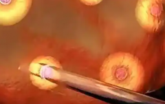 江西三代试管婴儿费用一览表，权威公布