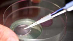 高成功率陷阱？柬埔寨试管包成套餐避坑指南