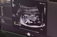 深圳市三代试管助孕费用贵不贵？单次治疗费用明细公布