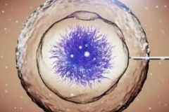 在浙江杭州做试管婴儿的私立医院真的能包成功吗？这会不会是骗局？