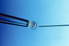 2026年未婚想做试管婴儿怎么办？毕节人民医院可以操作吗？