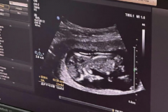 海口市第三代试管收费标准是多少？附2026年费用清单实例参考