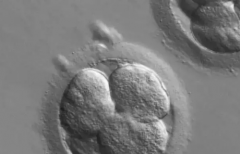 大连做第三代试管婴儿费用是多少？2026试管助孕花费明细