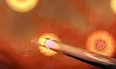 河北石家庄正规医院做三代试管婴儿费用大概是多少