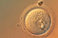 河南省三代试管助孕费用全面公开，详细费用清单一清二楚