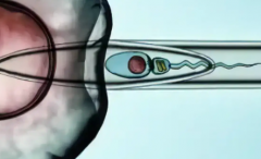 国内试管婴儿助孕大概花多少钱？2026年第三代试管费用明细出炉