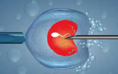 2026年未婚去海南附属二院做试管的总费用要多少？