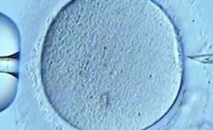 杭州市三代试管婴儿助孕生孩子费用全览表