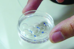 郑州市第三代试管助孕费用全解析2026：各项开支清晰呈现