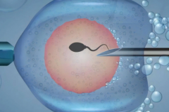 吉尔吉斯斯坦第三代试管助孕费用多少？费用预算与省钱方法分享