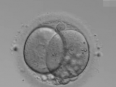 2026年广元中心医院单身试管婴儿花费明细表参考