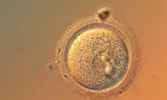 石家庄试管助孕包成功套餐可信吗？石家庄私立试管医院套餐是否靠谱