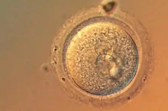 济南市做第三代试管助孕花销清单：附各大项目费用明细表