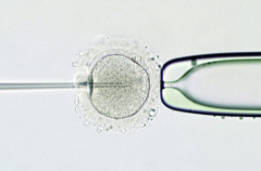 西安市第四医院能接受单身女性做试管助孕吗？