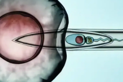 2026年在国内做三代试管婴儿真的能包成功吗？流程与注意事项全解析