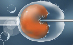 格鲁吉亚试管包成功服务可信吗？业内人士透露关键细节