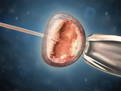 马来西亚做三代试管的医院包成功靠谱吗？有哪些限制条件？