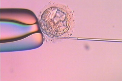 日照市人民医院接受无结婚证试管婴儿申请吗？费用及成功率一览表