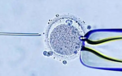 青岛妇幼未婚女性试管婴儿成功率怎么样？