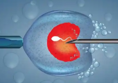 乌克兰试管婴儿宣称包成功？这些关键细节你必须知道