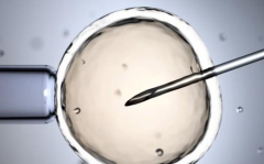 四川成都市做试管婴儿包成功需要的条件有哪些？