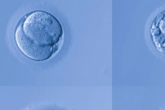 单身人士在北京大学第三医院能做试管婴儿吗？大概要多少钱？